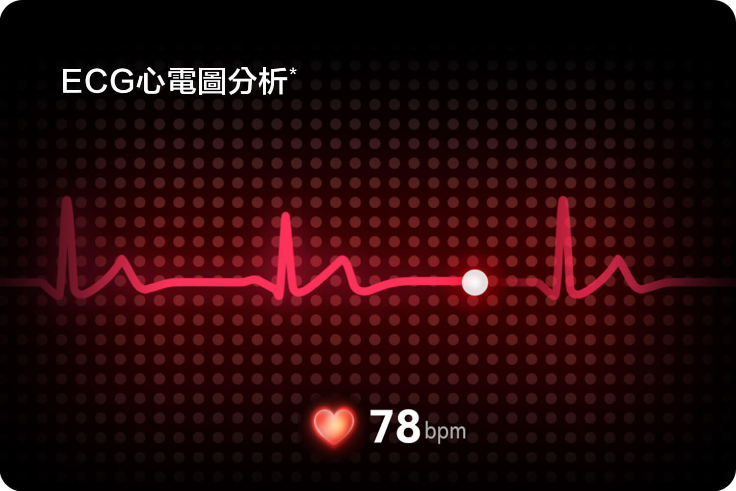 ECG 心電圖分析*